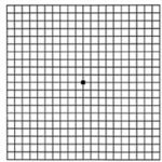 Age-Related Macular Degeneration