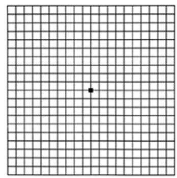Age-Related Macular Degeneration