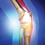 Why Your Knee Hurts