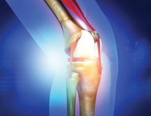 Why Your Knee Hurts
