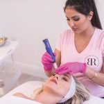 MICRONEEDLING