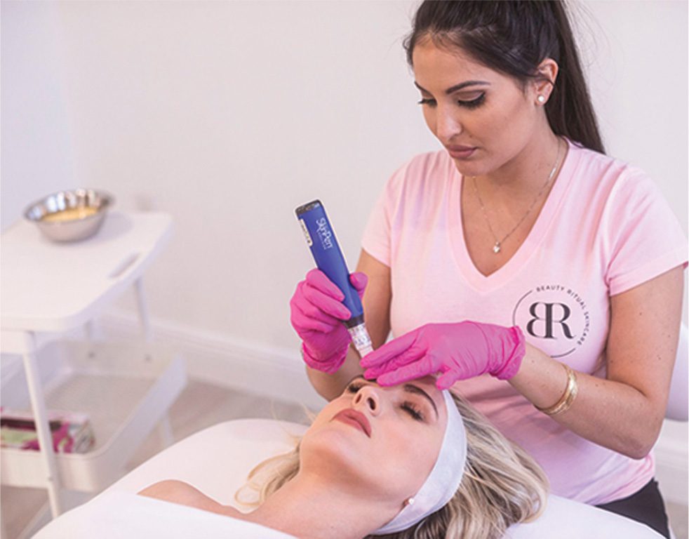 MICRONEEDLING
