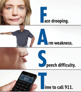 Understanding Stroke Symptoms