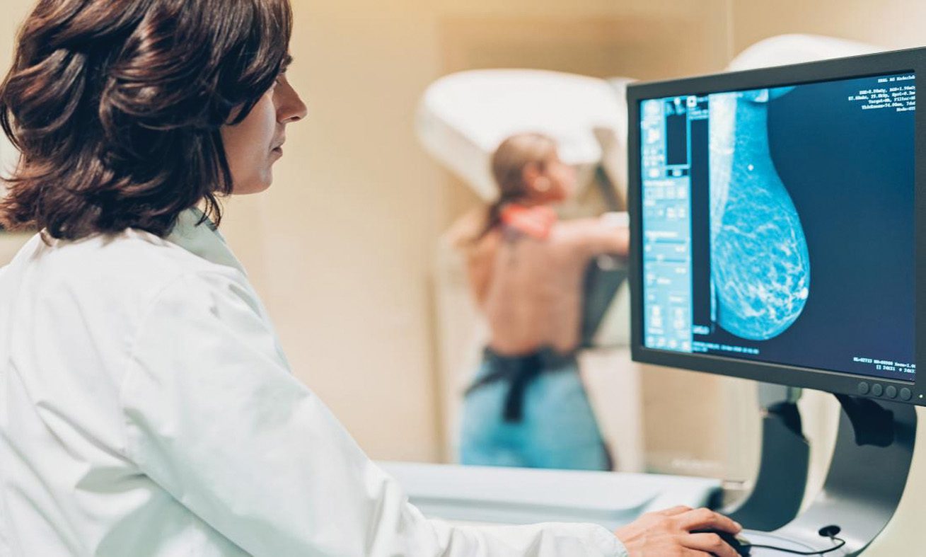 3D Mammography