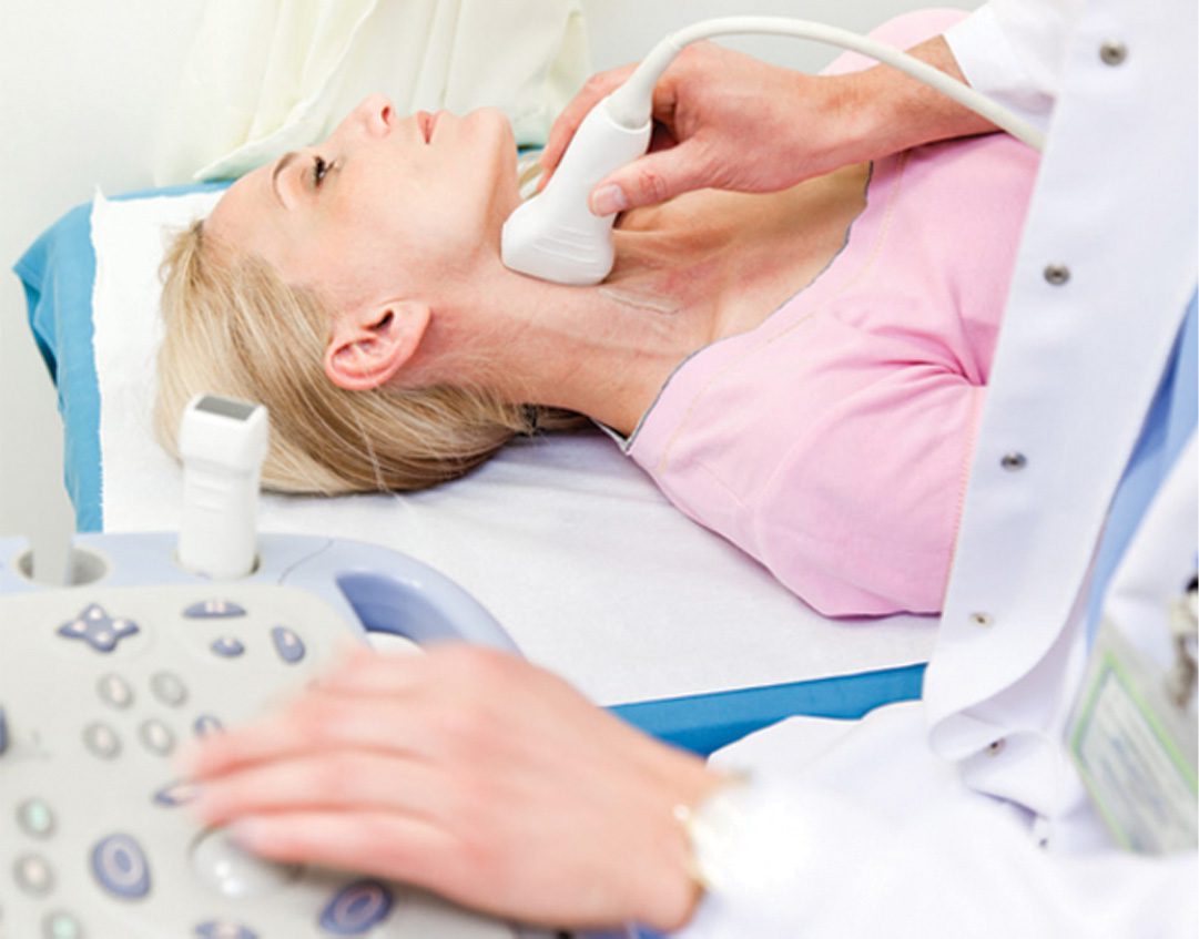 Carotid Artery Screening