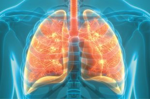 Respiratory Health Issues