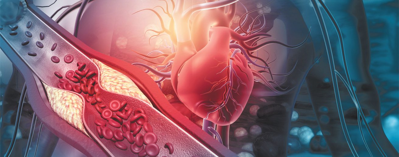 Cholesterol Awareness