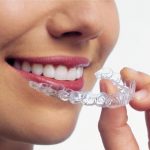 Invisalign Treatment