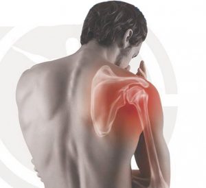 Shoulder Pain & Injuries