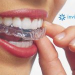 Invisalign