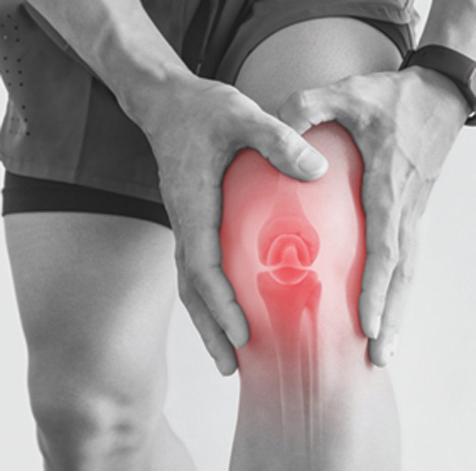 Do You Need Knee Replacement Surgery? What You Should Know • Southwest