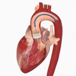 Interventional Cardiologis