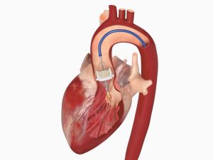 Interventional Cardiologis