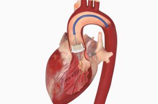 Interventional Cardiologis