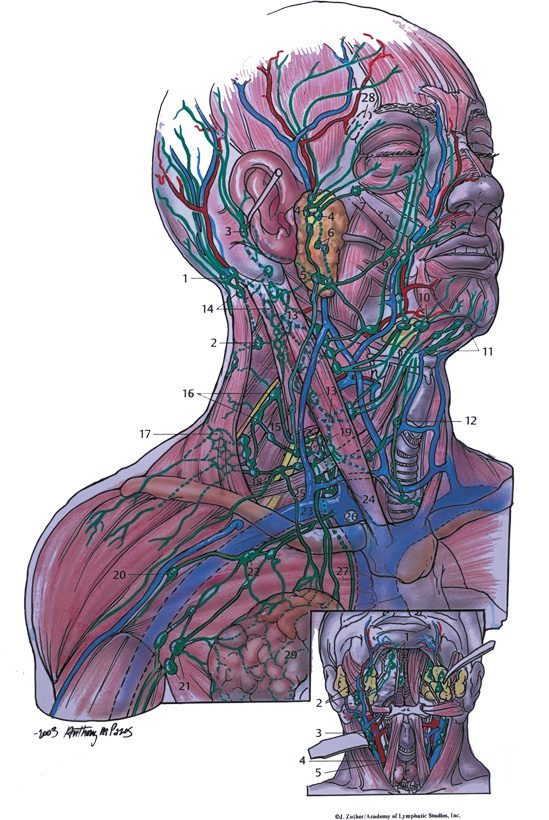 Head and Neck Lymphedema Related to Cancer and Radiation • Southwest ...