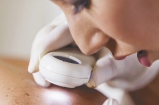 Skin Cancer Screening