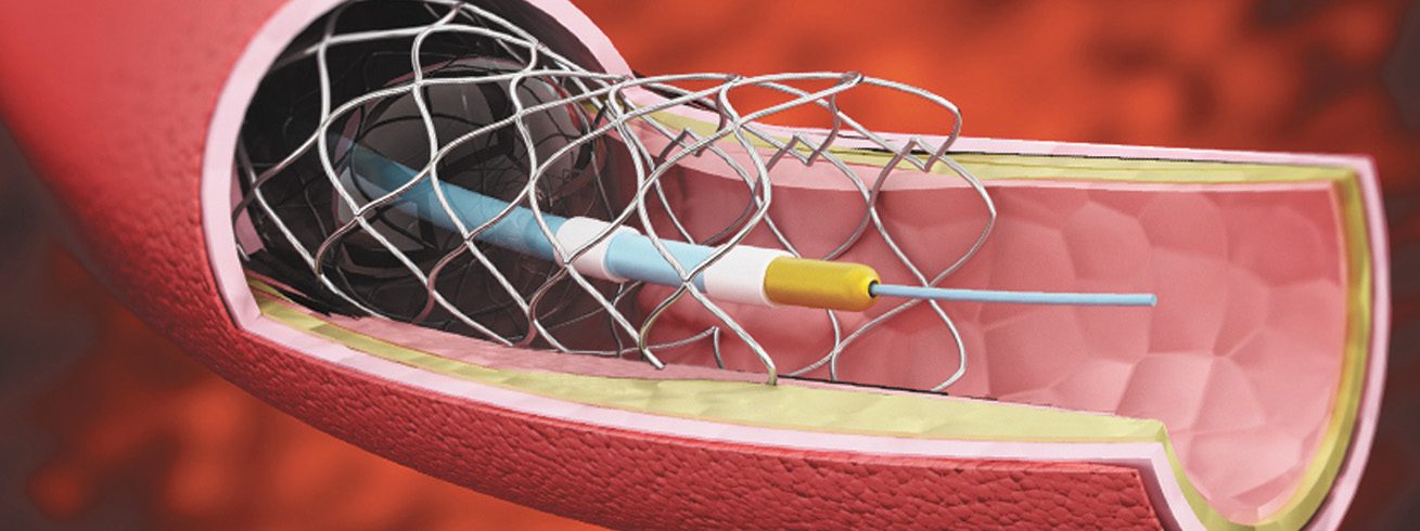 Interventional Cardiologist