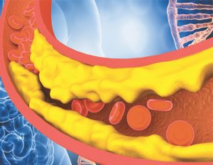 Cholesterol Education