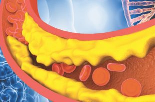 Cholesterol Education