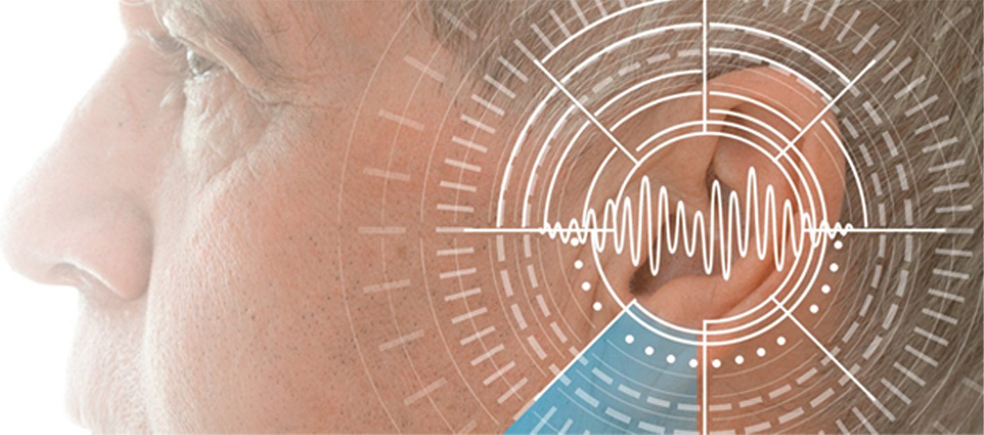 ASK THE EXPERT How To Stop The Ringing In Your Ears • Southwest Florida