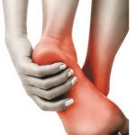 Plantar Fasciitis