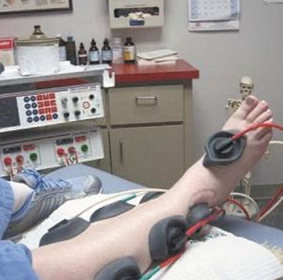 Neuropathy