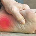 Peripheral Neuropathy