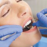 Sedation Dentistry