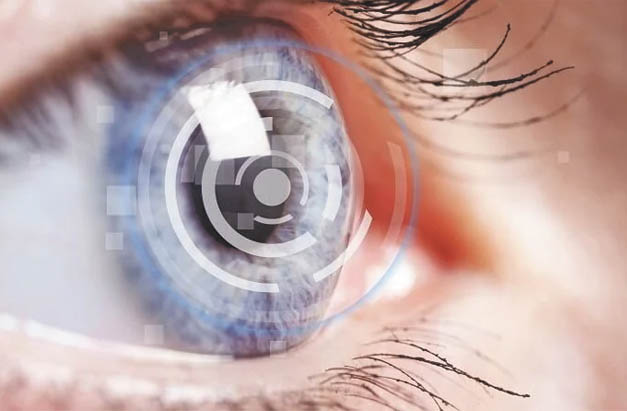Cataract