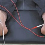 Electrotherapy