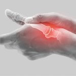 CBD and Arthritis