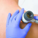 Skin Cancer Screenings