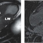 Cardiac Advanced Imaging