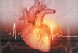 Understanding Heart Arrhythmias and Palpitations