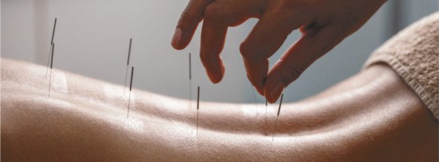 Acupuncture and Traditional Chinese Medicine in Mental Health