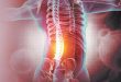 The Non-Surgical Solution to Chronic Disc Pain