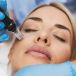 Microneedling