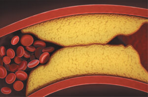 What is Cholesterol