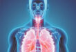 Lung Cancer Screening Saves Lives. Should You Have One?