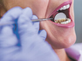 Oral Cancer