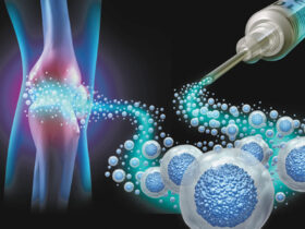 Orthopedic Conditions