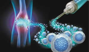 Orthopedic Conditions
