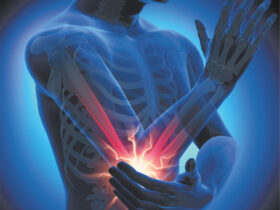 Shockwave Therapy
