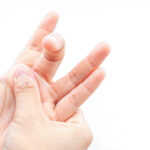 Trigger Finger