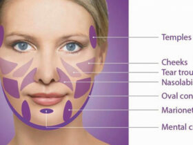 Facial Rejuvenation