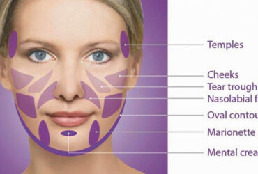 Facial Rejuvenation