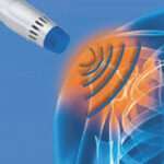 Shockwave Therapy