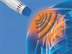 Shockwave Therapy
