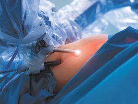 Spine Surgery
