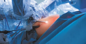 Spine Surgery